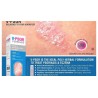 V-Psor Psoriasis Cream 100 gm