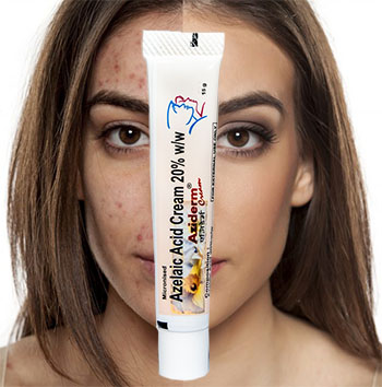 aziderm woman