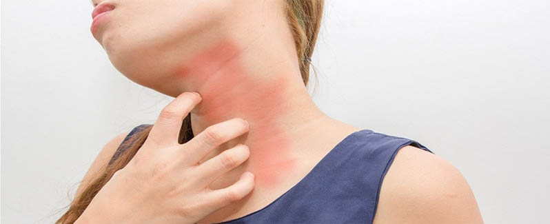 inflammation