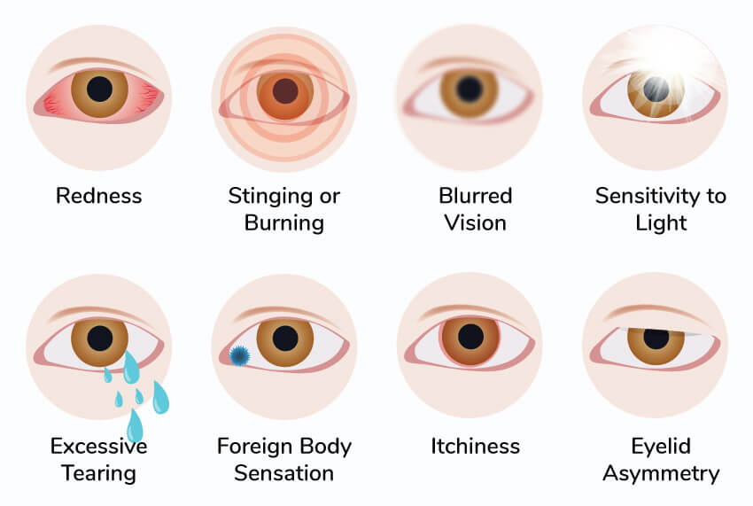 eyelashes problems