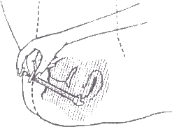 Generic Estrace application