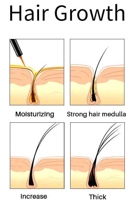 hair growth scheme