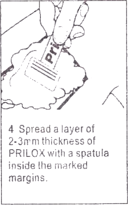 Prilox cream or Generic Emla application