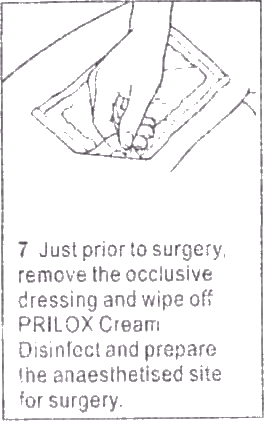 Prilox cream or Generic Emla application