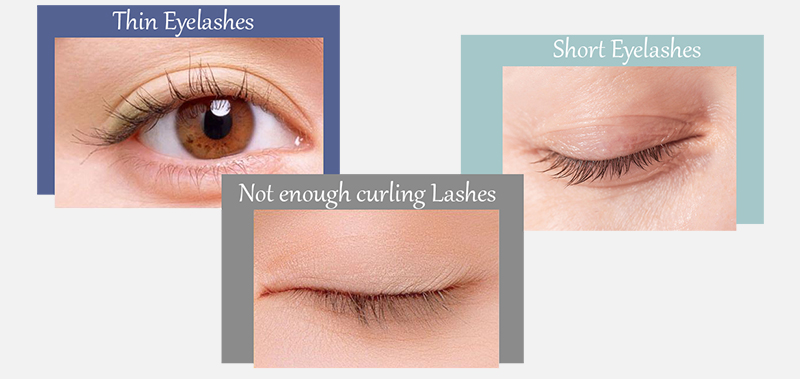 eyelashes problems