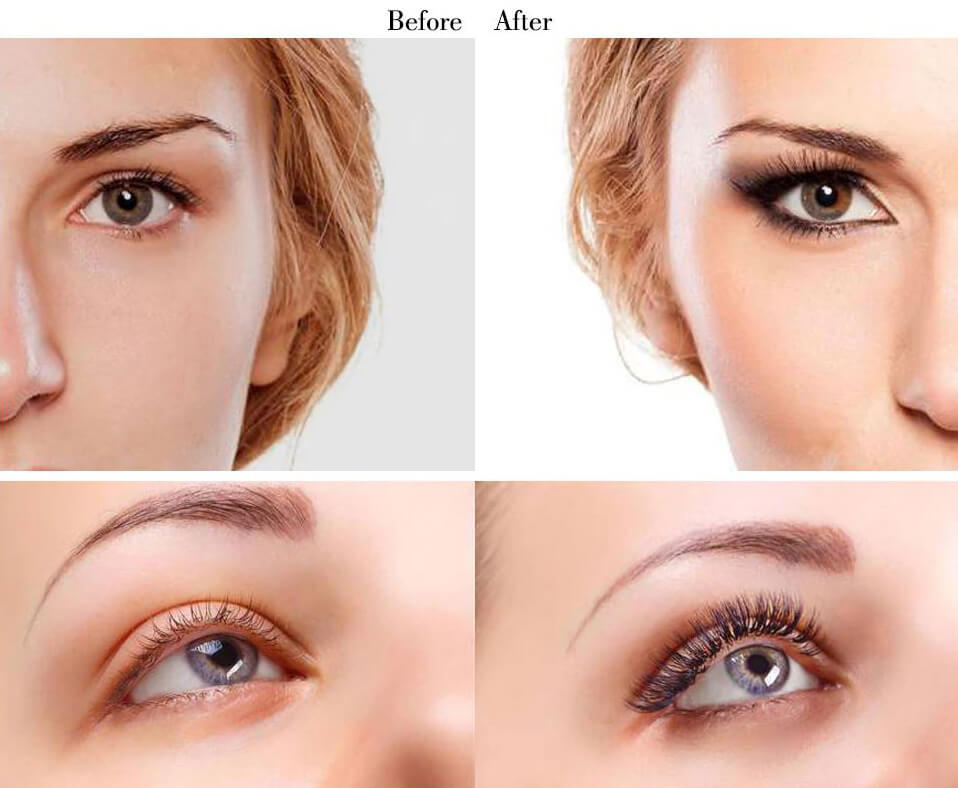 generic latisse before after