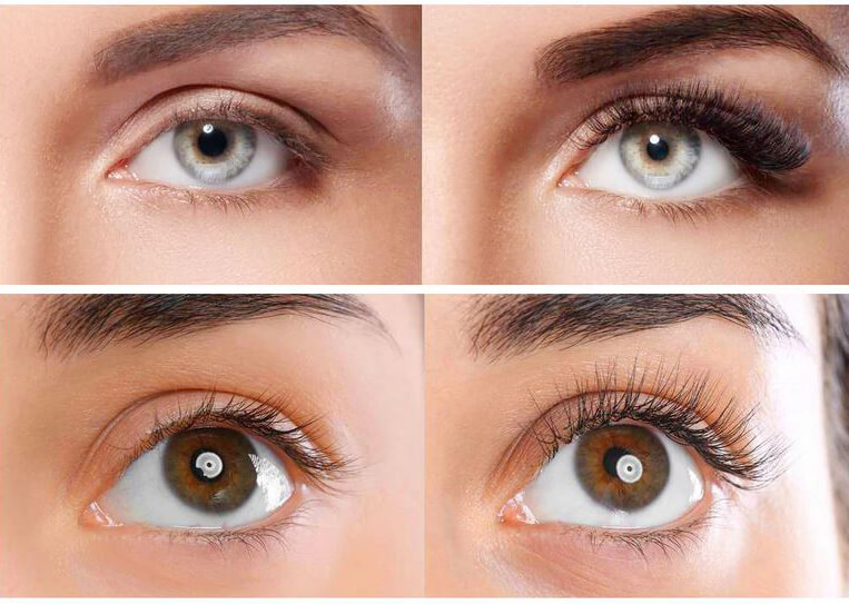 generic latisse before after