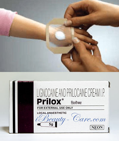 generic emla cream prilox