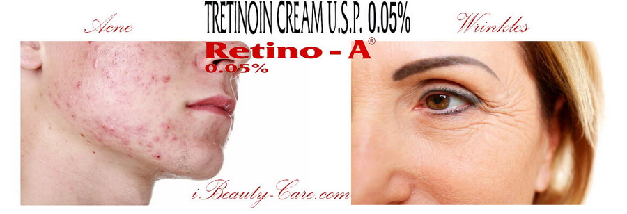 acne wrinkles problems