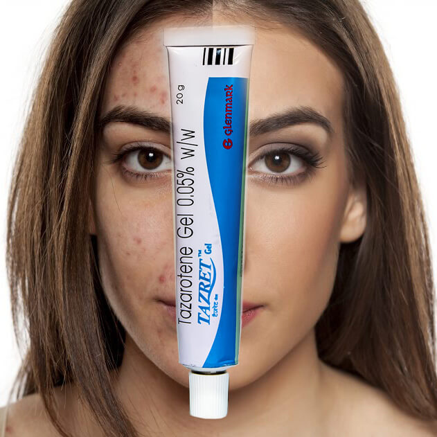 Acne tazorac