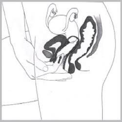 how to use v-firm step3