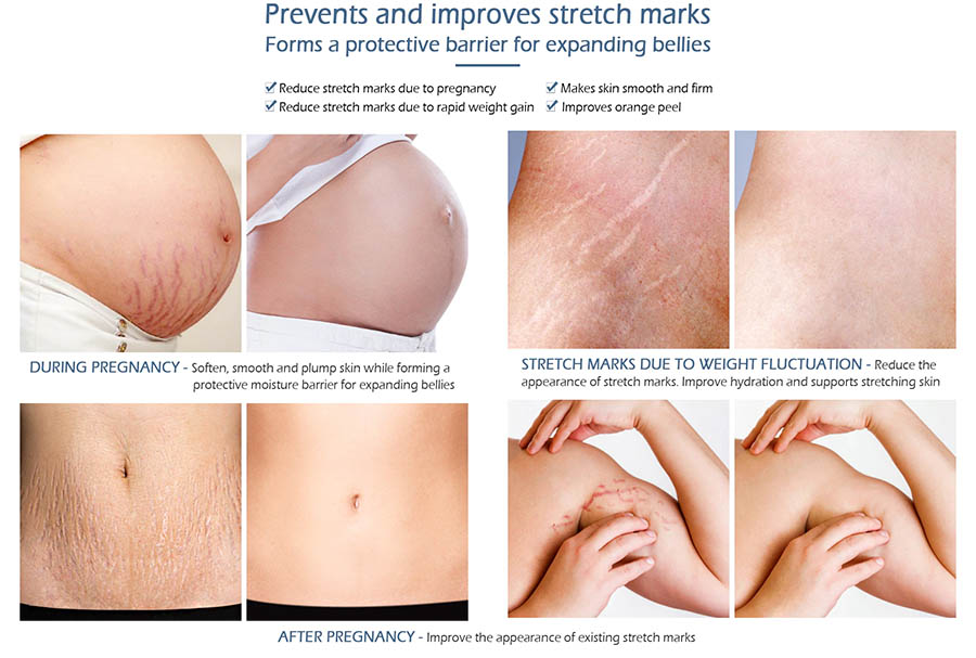 v-mark improves stratches