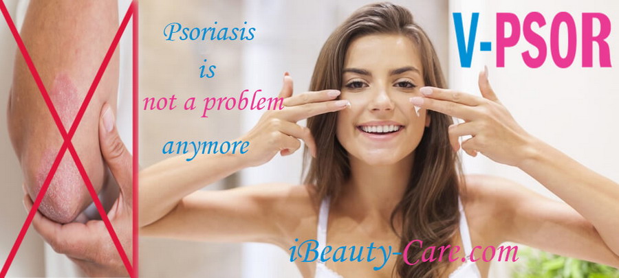 psoriasis not a problem