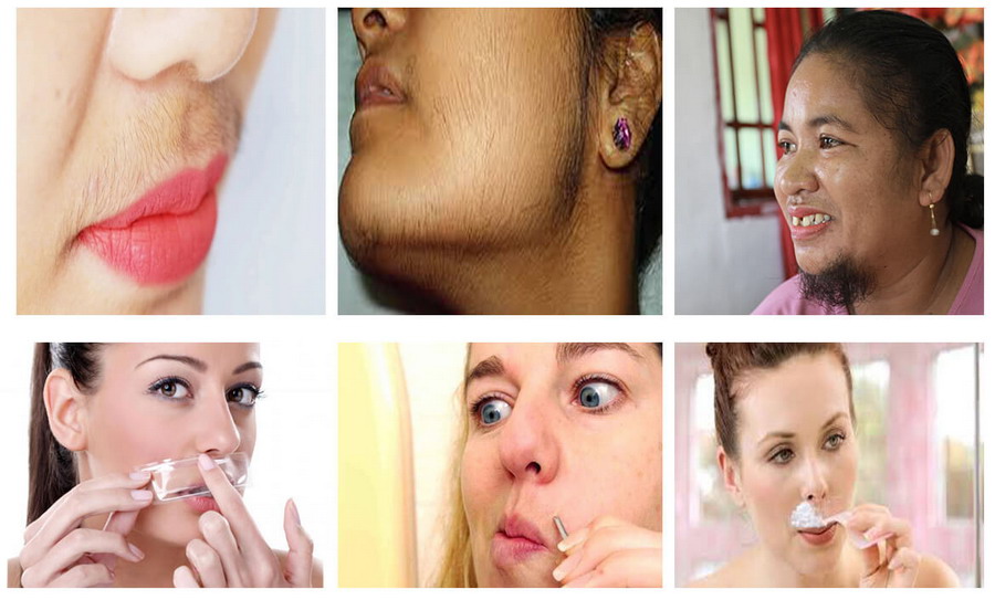 women with hair on their face